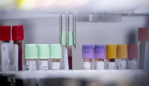 A Common-Sense Approach to Bloodwork