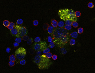 Innovative cancer therapies 