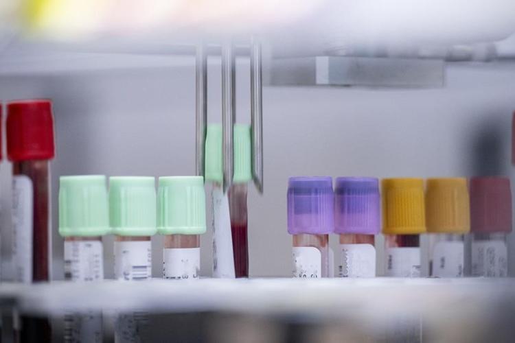 A Common-Sense Approach to Bloodwork